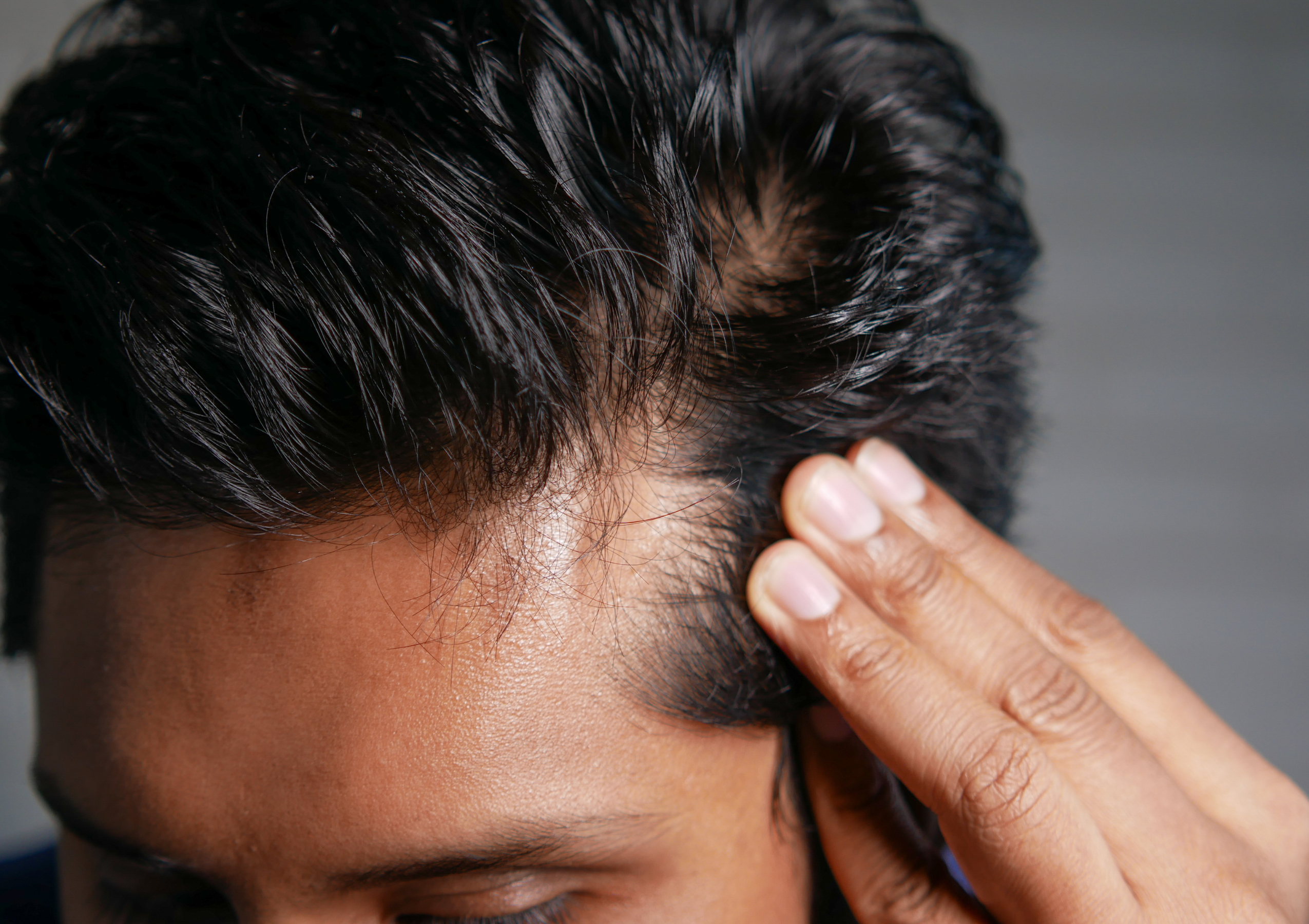 August is Hair Loss Awareness Month